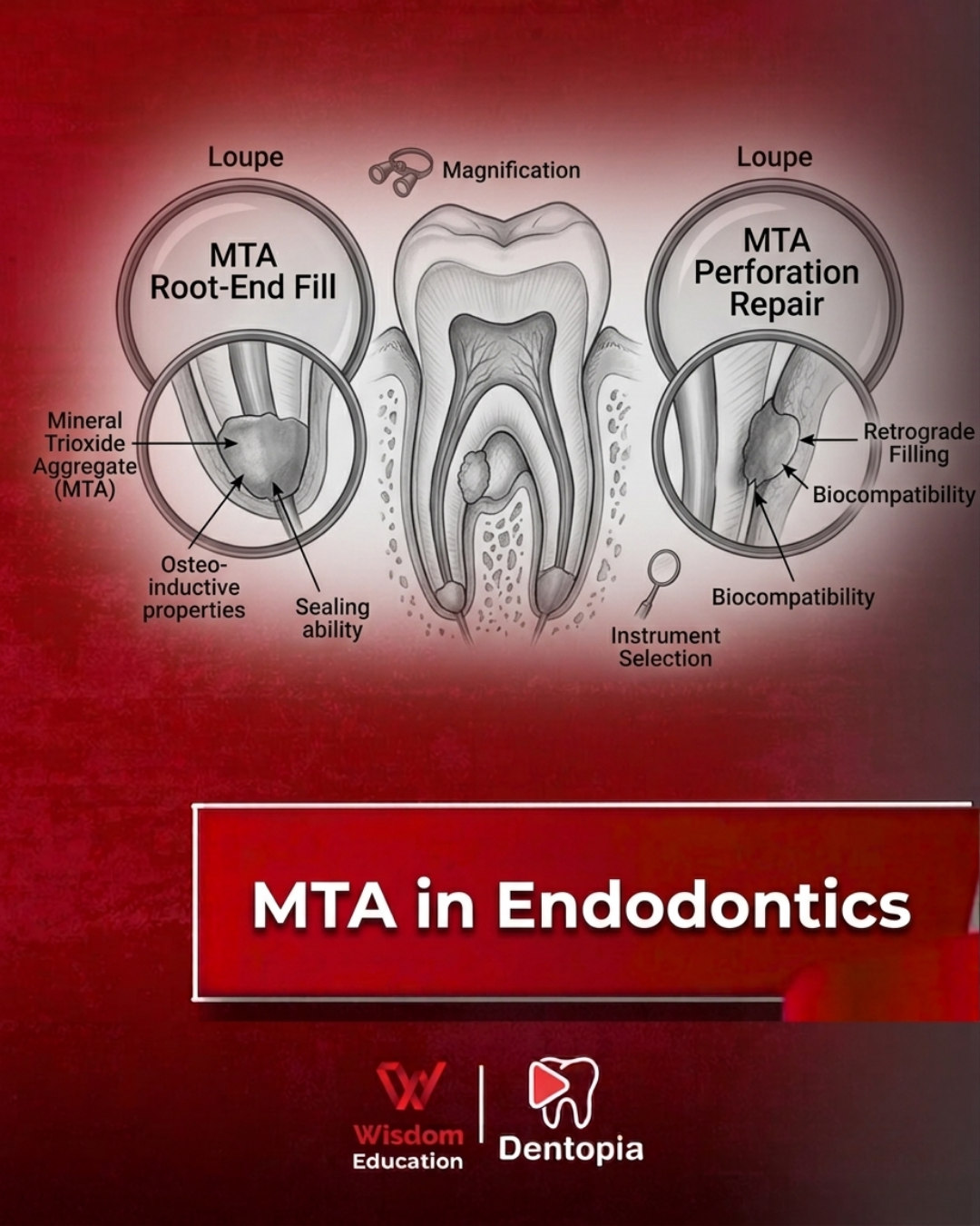 Endo Rotary File Set